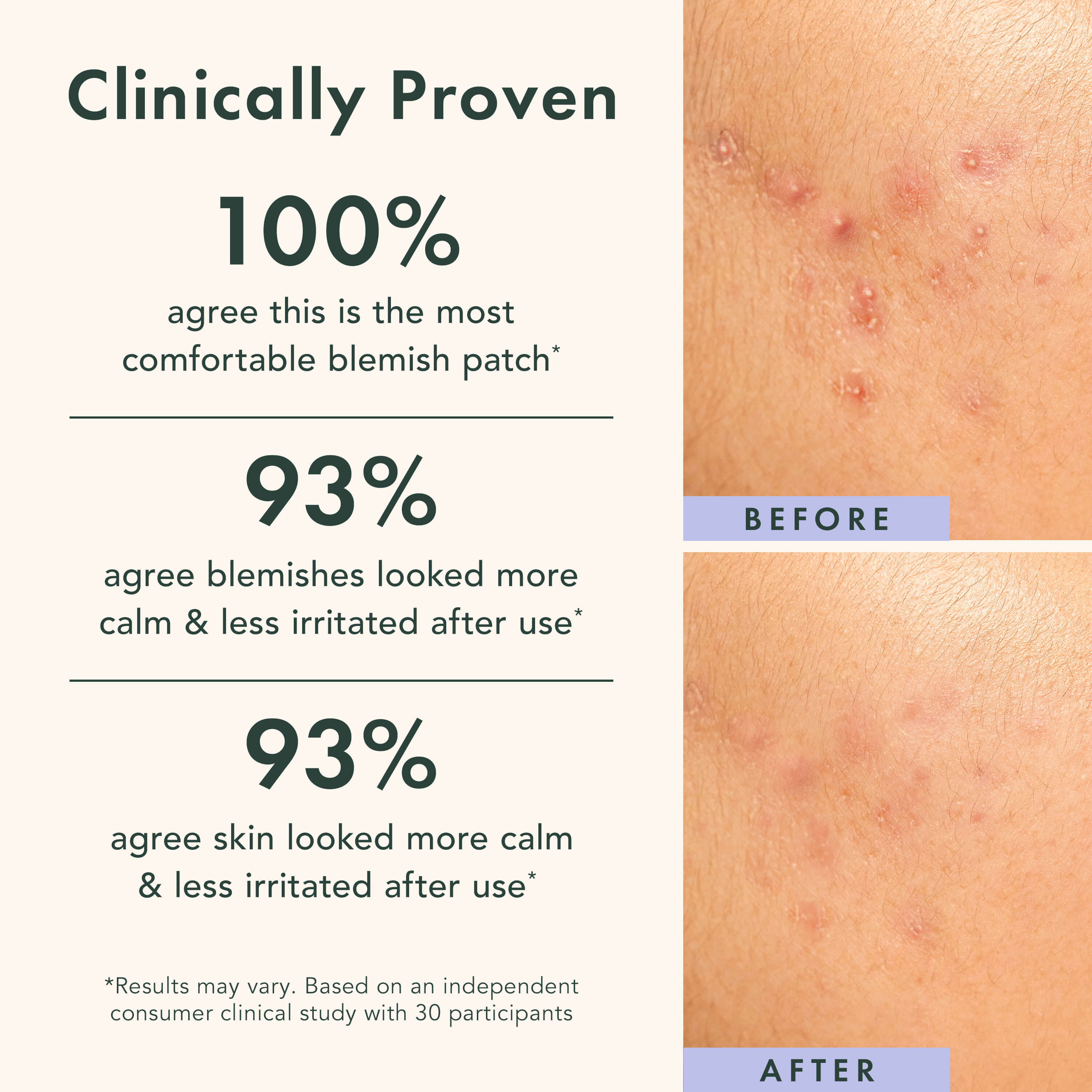 Miracle Patch Spot Control Cover